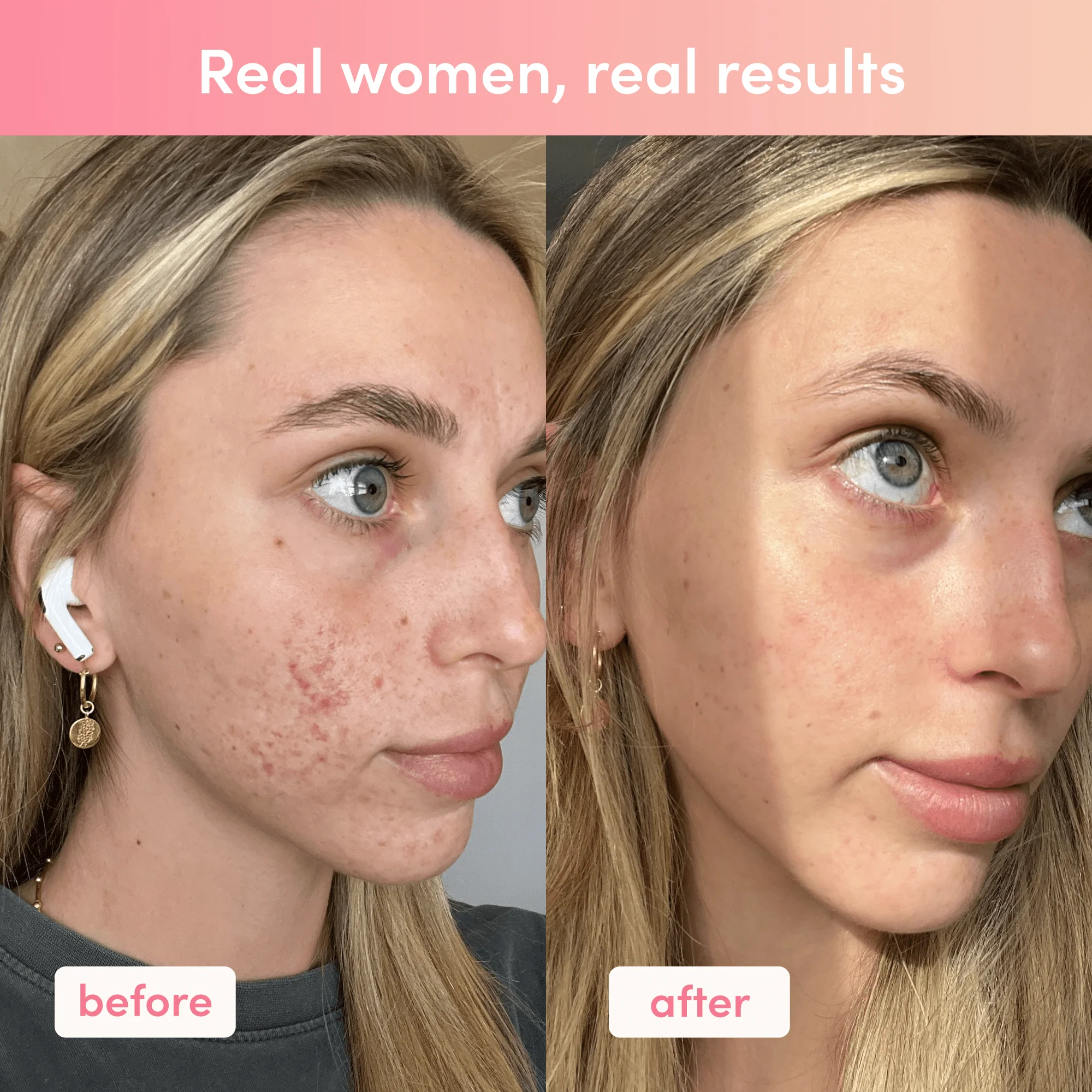 Premium Collagen Peptides Starter - Image 5