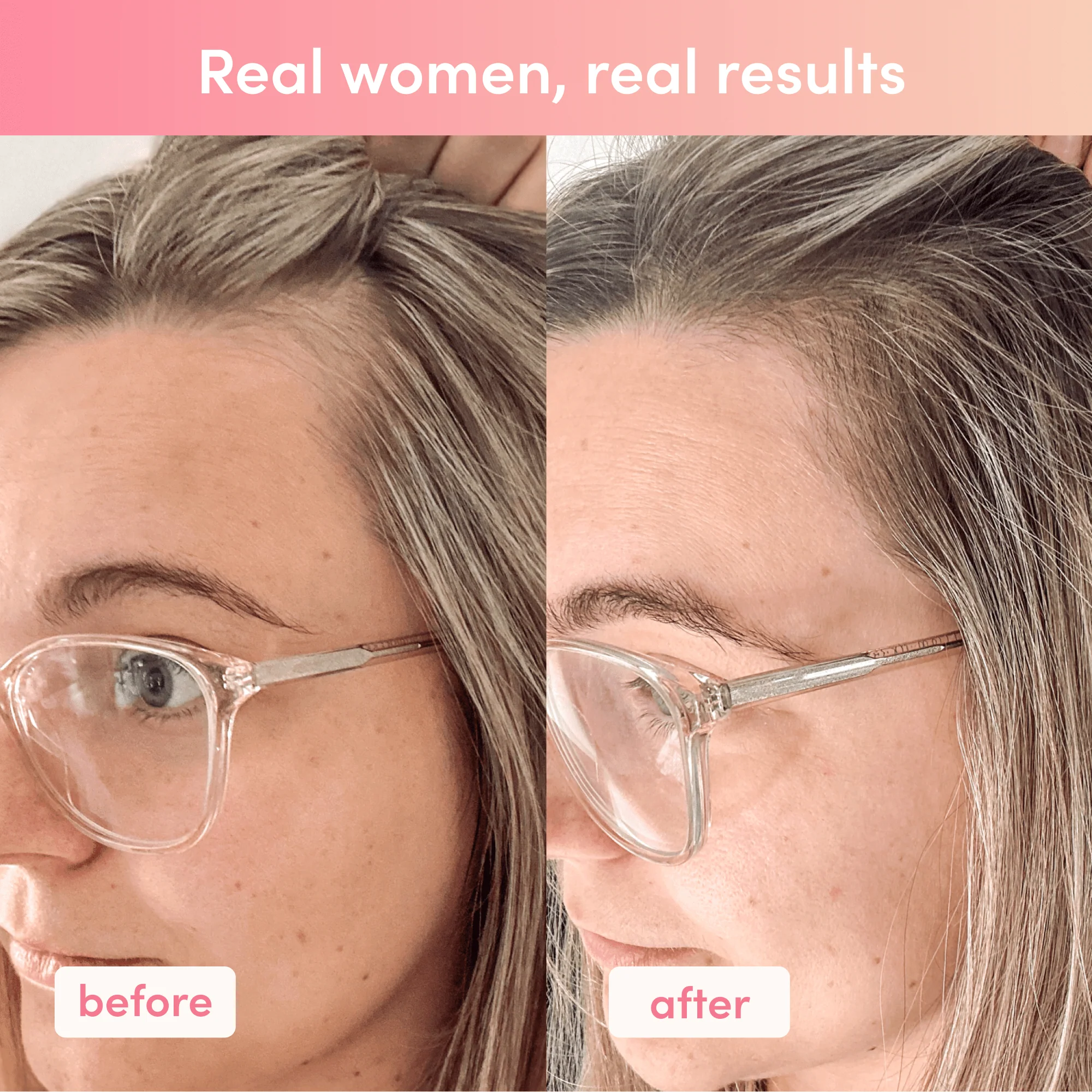 Premium Collagen Peptides Starter - Image 6